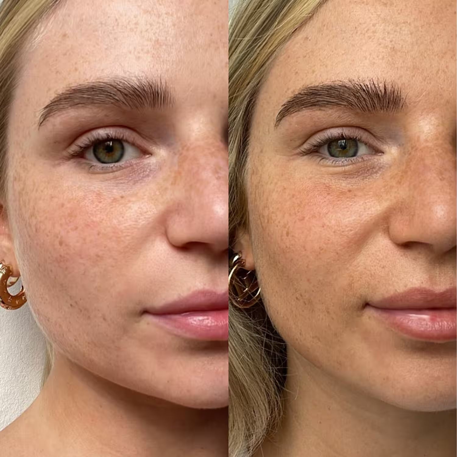 FACE® Self tanning drops